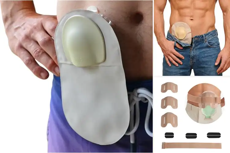 Detailed view of Best Stoma Guards: Reliable Protection & All-Day Comfort