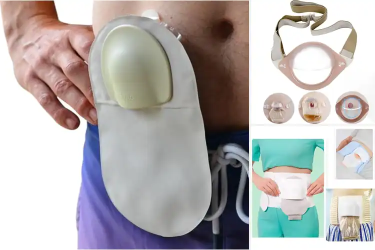 Detailed view of Best Stoma Security Shields : Ultimate Comfort & Confidence